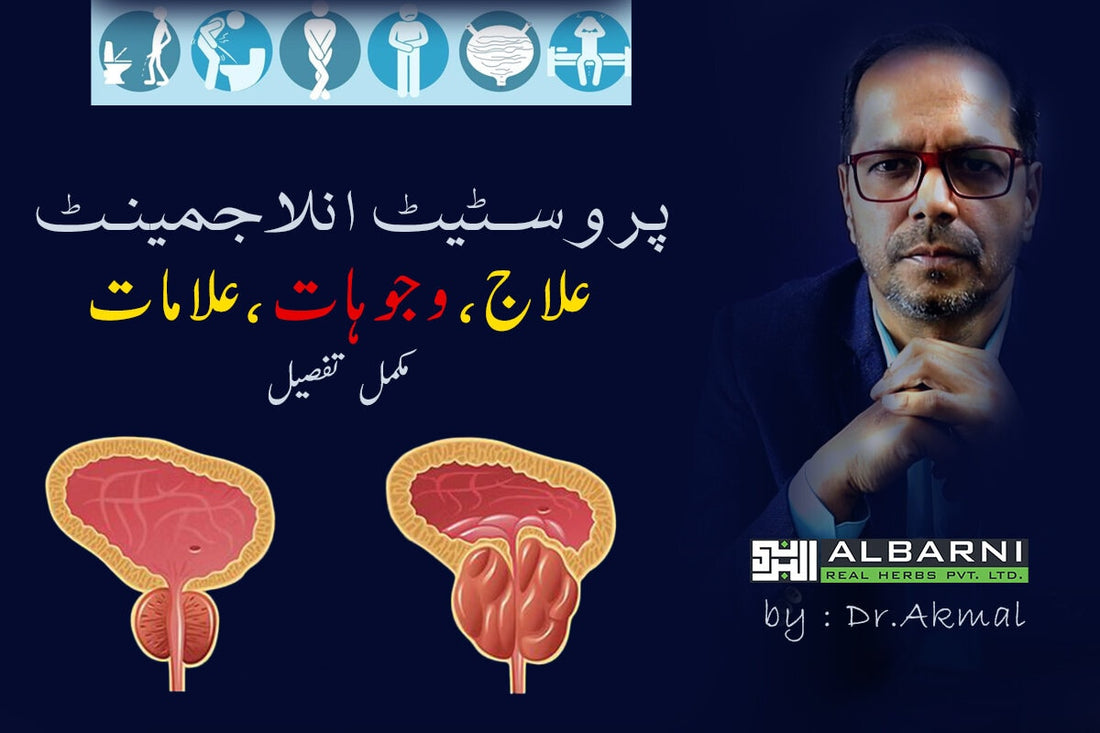 Enlarged Prostate Gland ka Ilaj,  Symptoms & Treatment